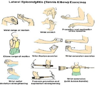 tennis elbow exercises